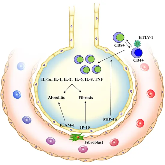 Human T Lymphotropic Virus 1 Infection